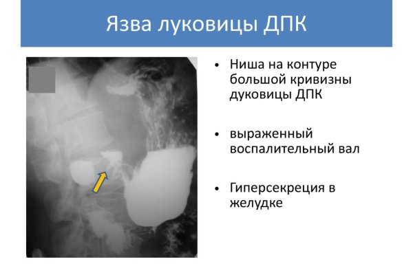 Kraken onion ссылка